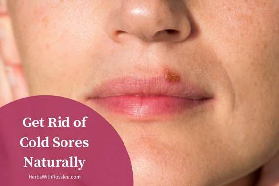 What is a treatment for a blister formation on the lips?
