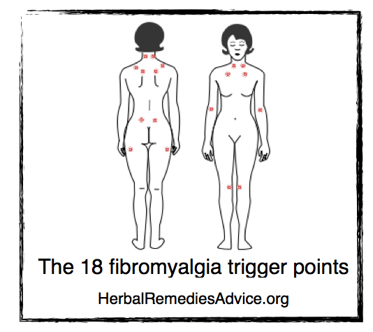 Fibromyalgia Trigger Points